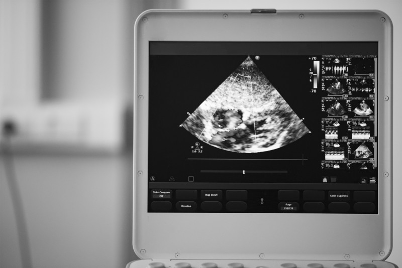 GE Ultrasound Machines In The Diagnosis Of Cardiovascular Disorders