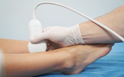 Problems That a Vascular Specialist in Fayetteville, GA Can Treat