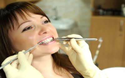 What to Expect Following the Placement of Dental Crowns in Fort Myers FL