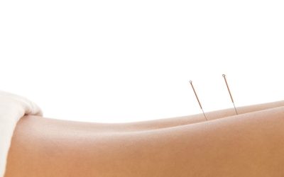 Acupuncture for pain in Berkeley, CA: A natural path to recovery