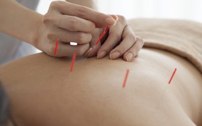 Enjoy The Many Benefits Of Acupuncture Treatment In Scottsdale AZ